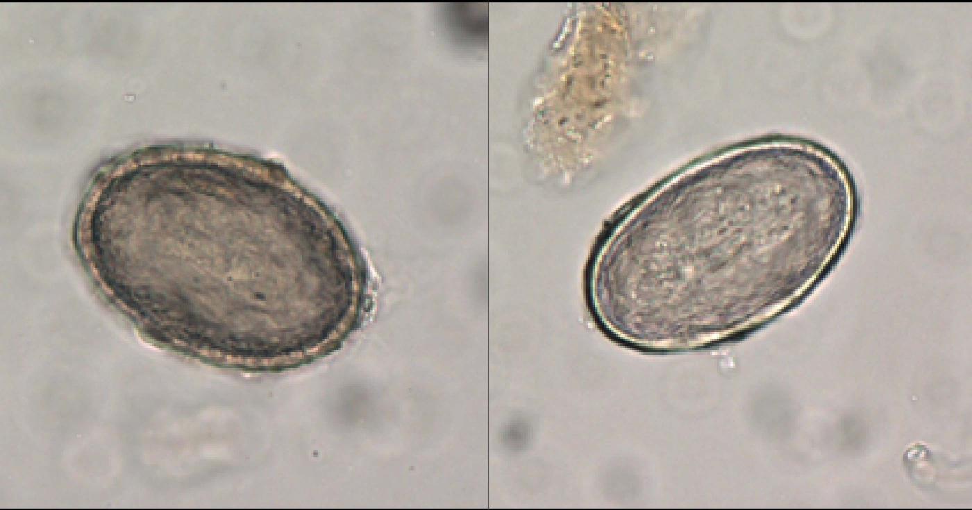 On aperçoit deux photos au microscope de cellules de parasites.