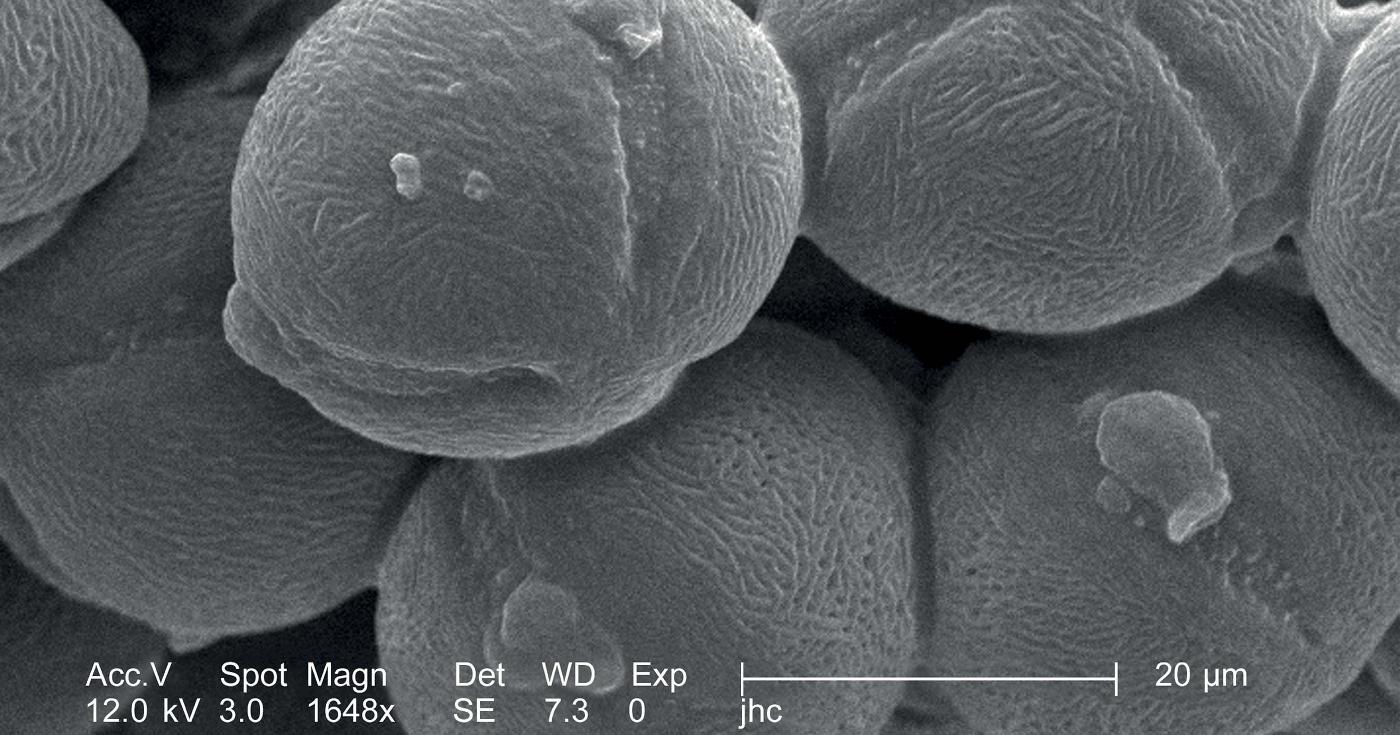 Vue au microscope de pollens.